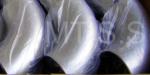 STAINLESS STEEL 180DEGREE ELBOWS